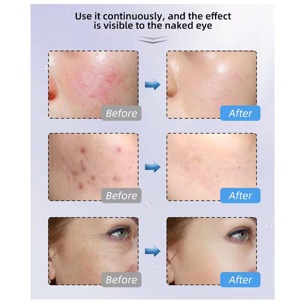 Máscara facial con terapia de luz LED 4 en 1, terapia de luz roja, antienvejecimiento, reducción de arrugas, reafirmación de la piel, blanqueamiento, máscara fotónica avanzada