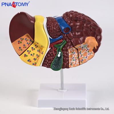 Medizinisches Simulations-Lebermodell: Anatomie, Pathologie, Gallengänge, Gallenblase & Verdauungssystem