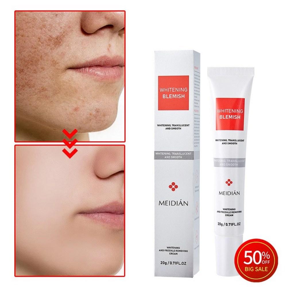 WHITENING BLEMISH {Noticeable Effect} Melatoning Melanon