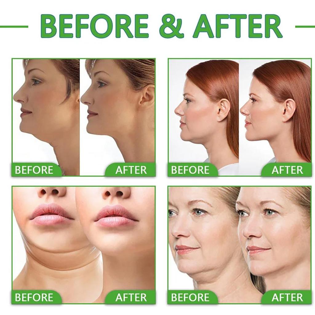 The Moisturizing Cream Is Gentle and Non-irritating, Hydrating and Nourishing the Skin, Leaving It Soft and Refined