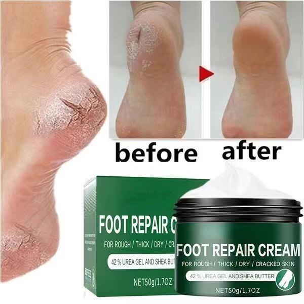 2021 Effective Odor Treatment Nourishing Anti Cracking Cream Skin Care Products Dead Skin Remover Chapped Repair Cream