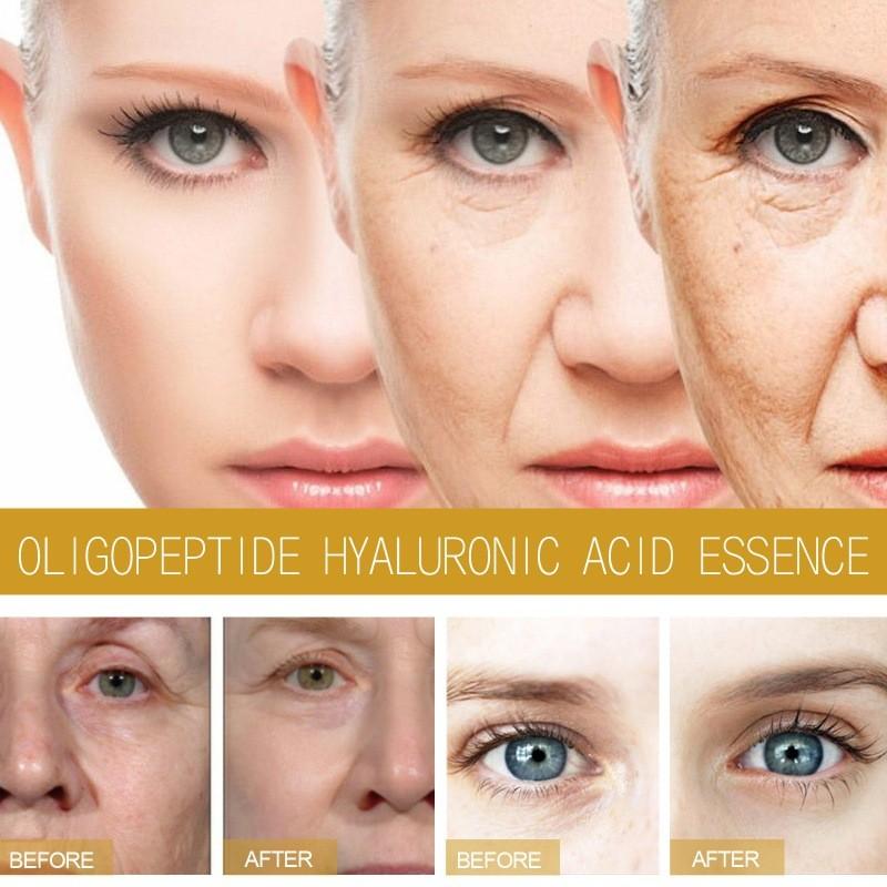 Eelhoe Collagen Essence Hydrating Firming Anti-aging Serum For Face Care