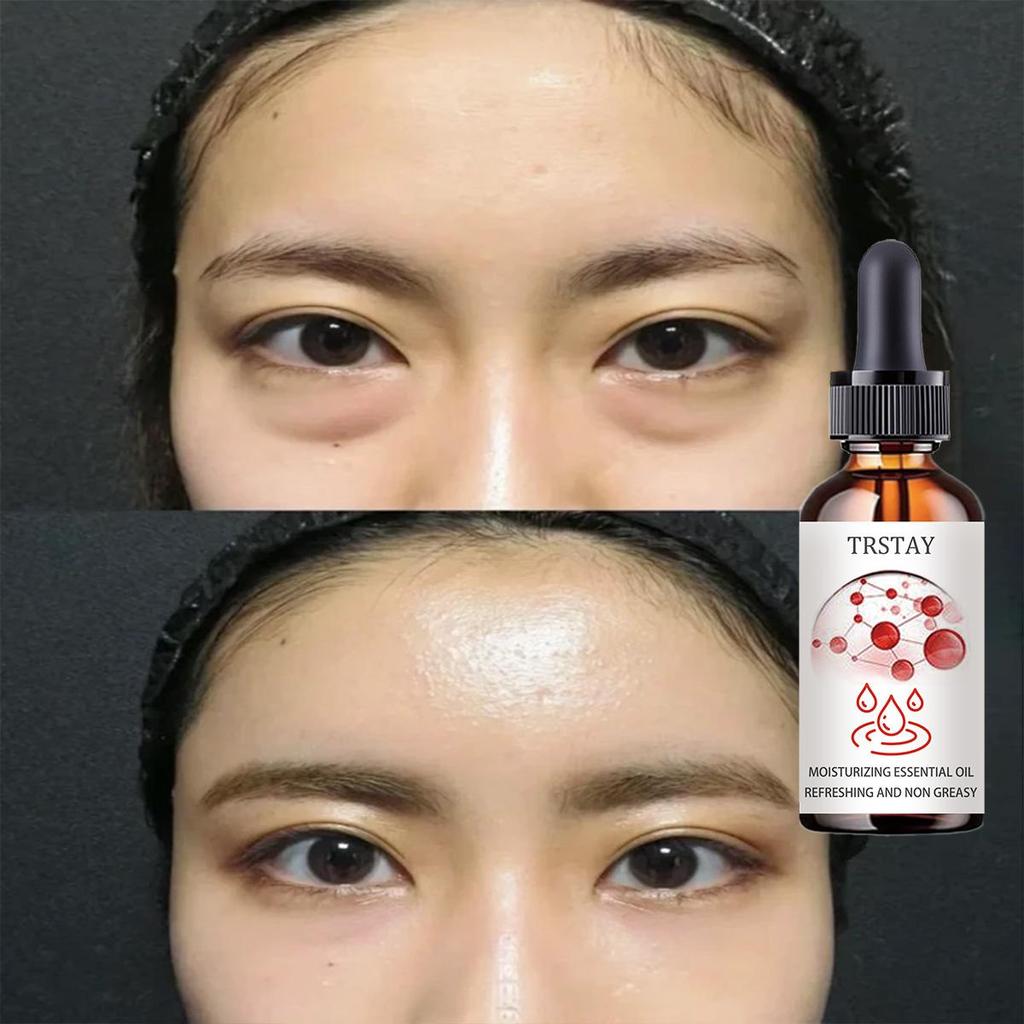 Repair Eye Cream, Care Eyes, Brighten and Tighten Damaged Skin Essence, Moisturizing and Nourishing Eye Independent Liquid