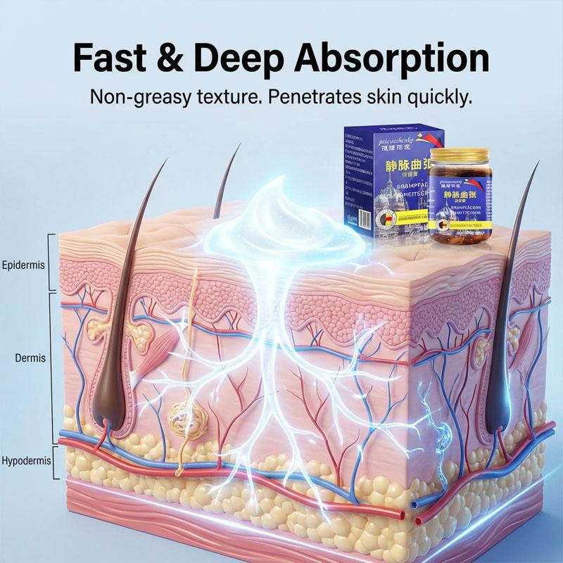 Varicose Vein Relief Cream - Herbal Leg Care Massage Ointment for Spider Veins, Swollen & Heavy Legs - Improves Circulation & Soothes Fatigue (50g)