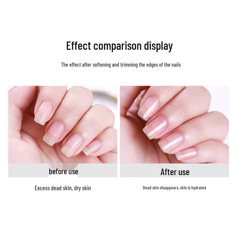 Gold Plated Stainless Steel Dead Skin Nipper & Ingrown Nail Clipper D501