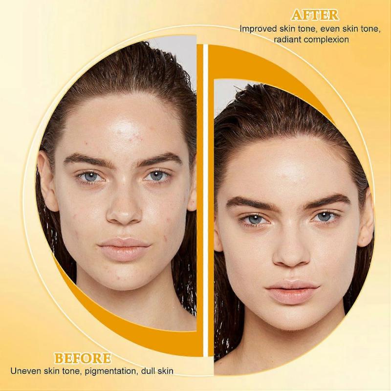 Lemon Turmeric Soap Flakes,Natural Handmade Skincare Deep Cleansing Face,Organic Turmeric Soap Body Bath Soap,Tighten Pores Lighten Scars Remove Pigme