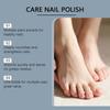 Nail Care Oil, Moisturizing The Fingertips, Nourishing The Nail Surface And Nail Oil,15ml