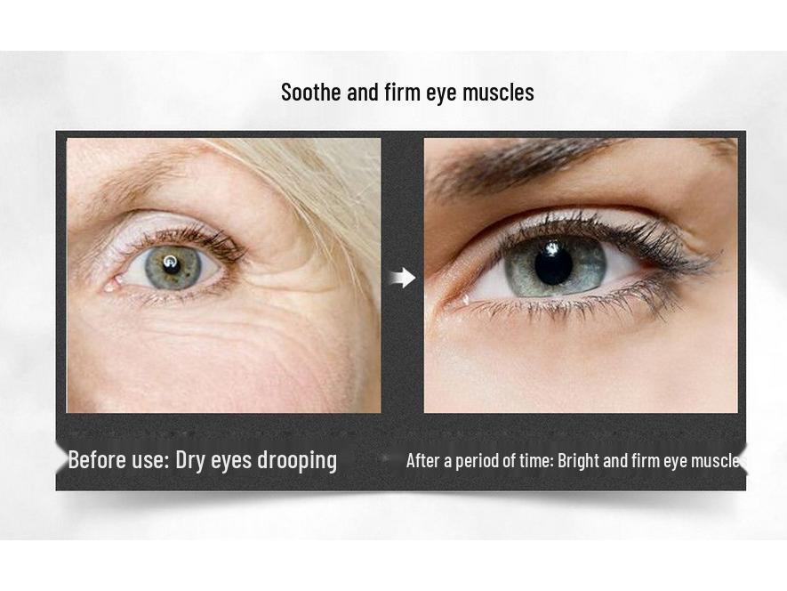 DSM Eye Cream for Dark Circles, Eye Bags, Fine Lines, and Milia - Lifting and Firming Formula