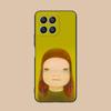 Anime Yoshitomo Nara Phone Case for Honor 90 80 70 60 50 30 20 10 9 8 7 Pro S SE Lite 5G Colorful Printing Cover Pretty Cover