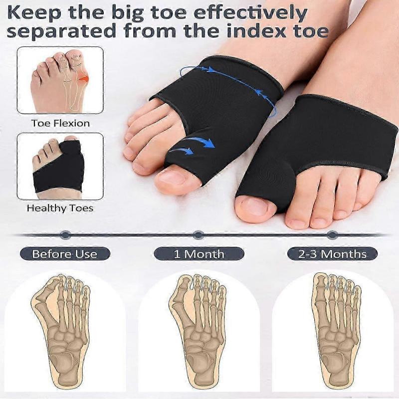 2 Pcs Bunion Corrector for Women Men Bunion Pain Relief, Big Toe Straighteners