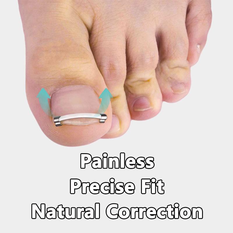 

Nail Stickers Paronychia Correction Paronychia Corrector Nail Straightening Patch 2 Pieces