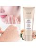 1pc Exfoliating Gel, Deep Cleansing And Exfoliating Gel For Face, Removes Blackheads, Dead Skin, Tig