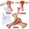 Female Pathology Uterus Model for Obstetrics & Gynecology Education