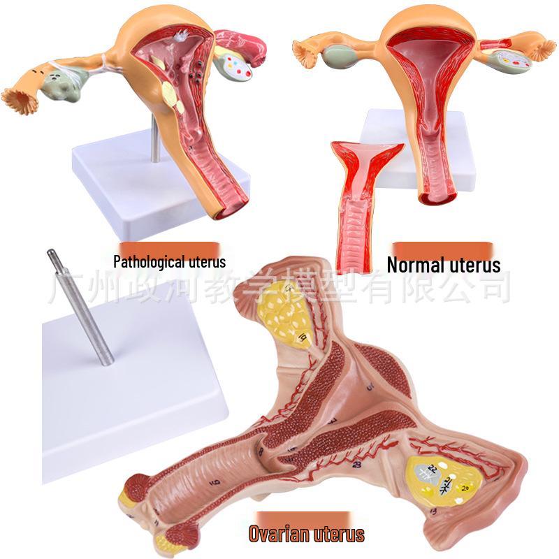 Female Pathology Uterus Model for Obstetrics & Gynecology Education
