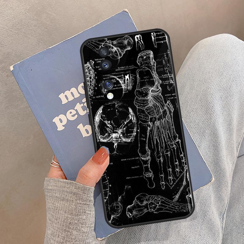 

Медицинский чехол-скелет для Honor Magic 8 7 6 5 Pro Чехол для Honor 400 200 X9c X9b X9a X8a X8b 50 70 90 Lite Honor 50