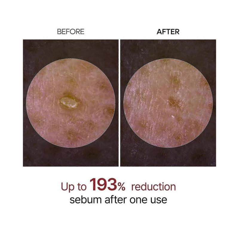 2PCS Peel Shot Glow Rice Ampoule, White Rice ampoule+Black Rice Ampoule Soft Exfoliating Face and Body Scrub Dead Skin Cells