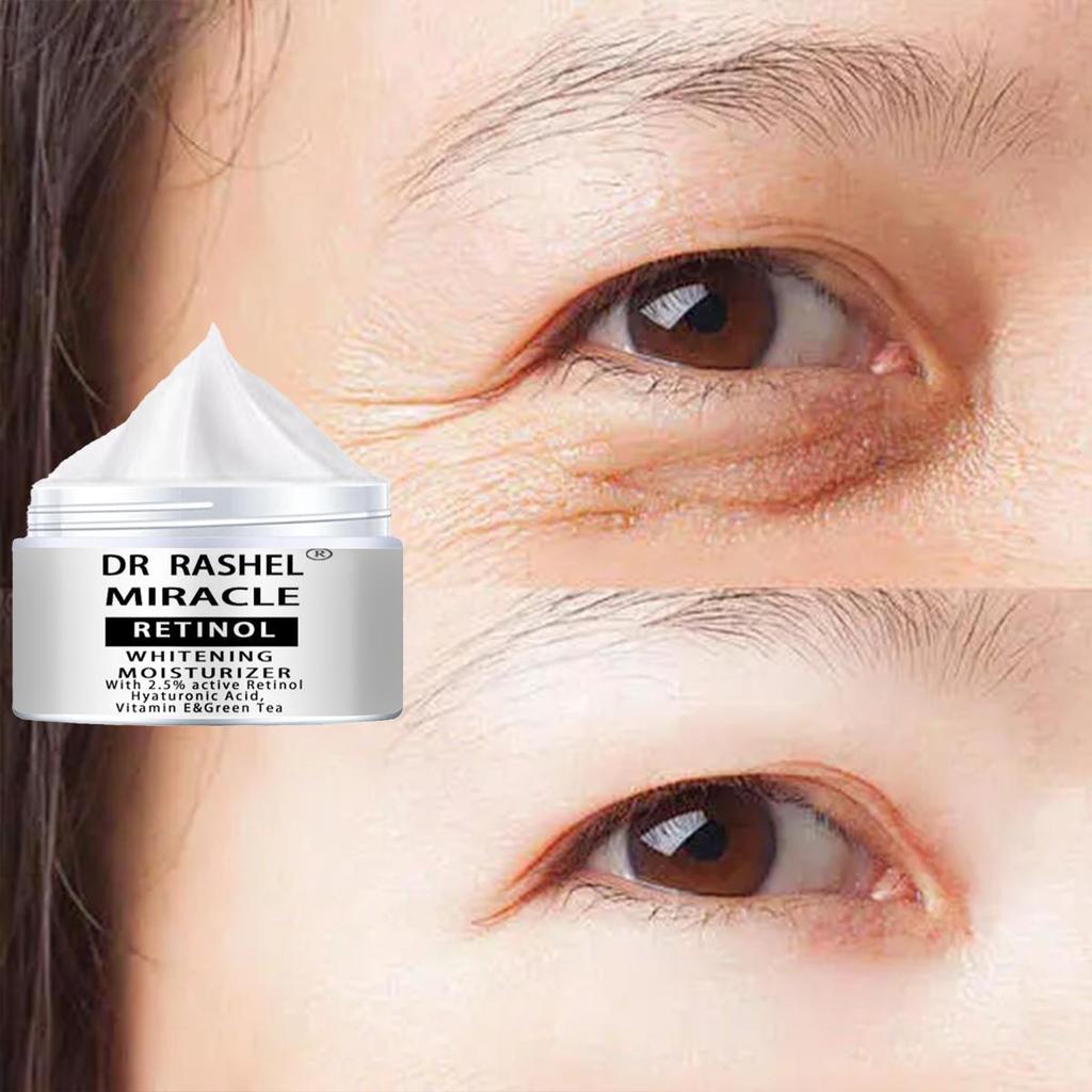 Active Retinol Eye Cream Anti Wrinkle Reduce Fine Lines Improve Dark Circles Anti Puffiness Anti Aging Eye Skin Care