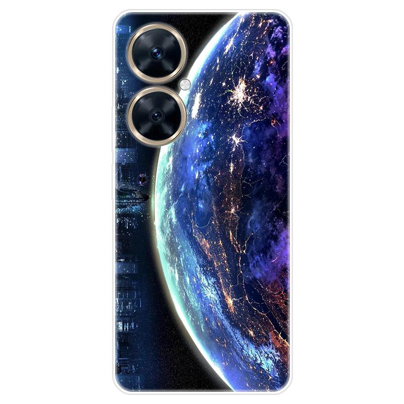 Für Huawei nova 11i nova11i Fall Weiche Silikon Zurück Abdeckung Cartoon Telefon Fall Diversifizierung