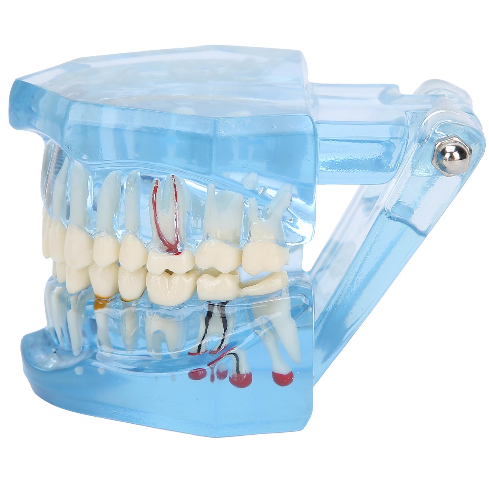 

Модель зубов, акриловая, синяя, прозрачная, обучающая, демонстрационная, имитация зубов, модель