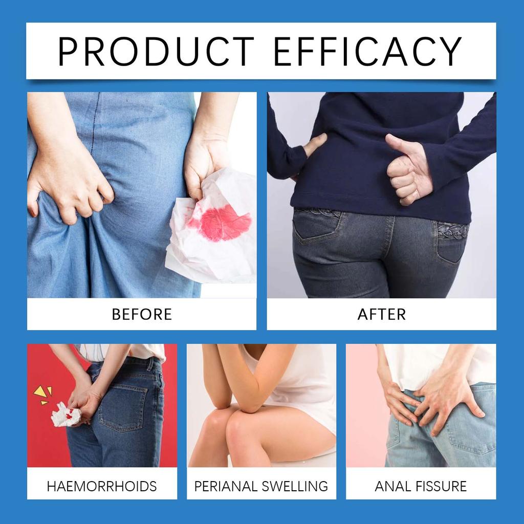 Hemorrhoid Relief Capsules Pain, Reduce Swelling And Itching, Promote Blood Circulation And Anal Care,3.5ML