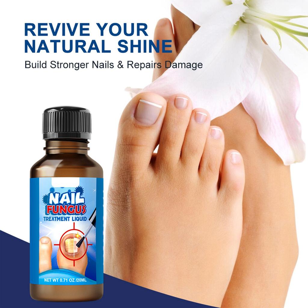 New Bright Potassium Care Liquid Onychomycosis Care Liquid New Bright Nails Onychomycosis Improves The Appearance Of Nails.20ML
