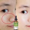 5ML/15ML/30ML/50ML/Vitamin B5 Face Serum Smooth Moisturizing Repair Dry Skin Aloe Soothe Pores Shrink Firming Hydrating Oil Control Facial Essence