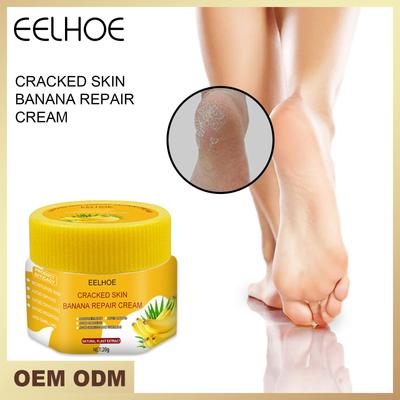 Rissige Haut Banana Repair Cream Hautrissige Füße Pflege