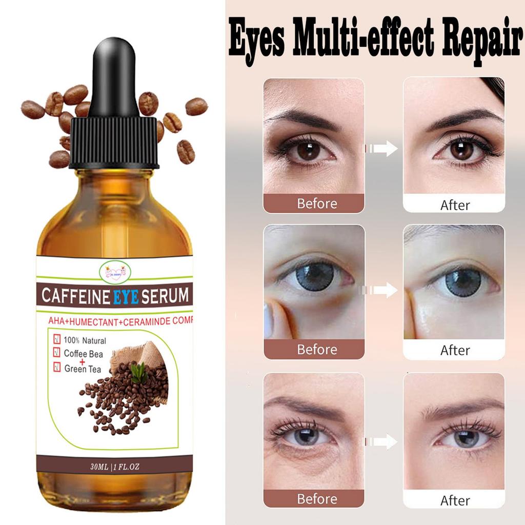 30ml Kafein Siyah Göz Yuvası Göz Kremi, Göz Masaj Kremi