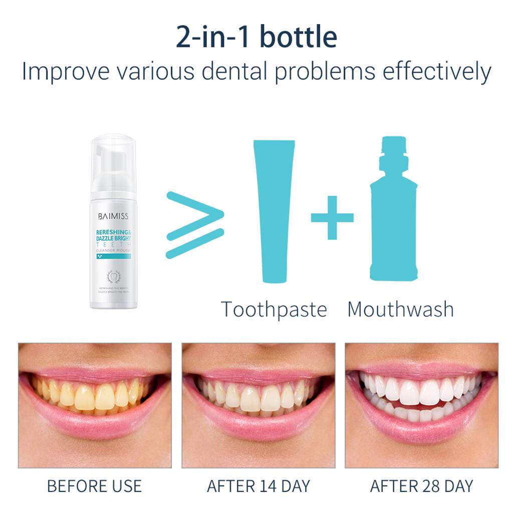 Mpps Toothpaste PP-Cleaning Mousse Toothpaste Oral Hygiene Removes Plaque Stains uygun ...