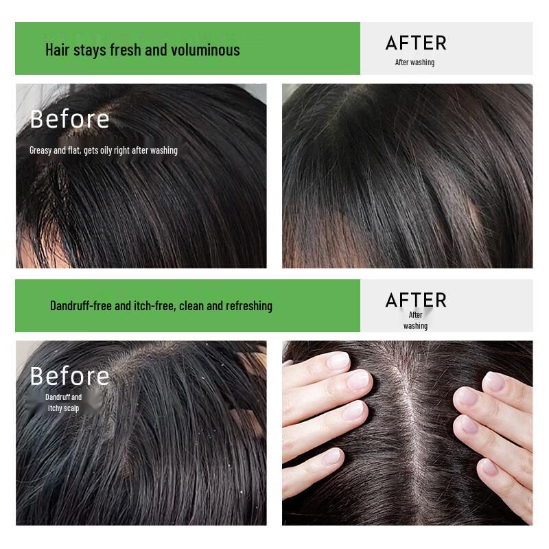 Ketoncom Oil Control Anti-Dandruff Shampoo