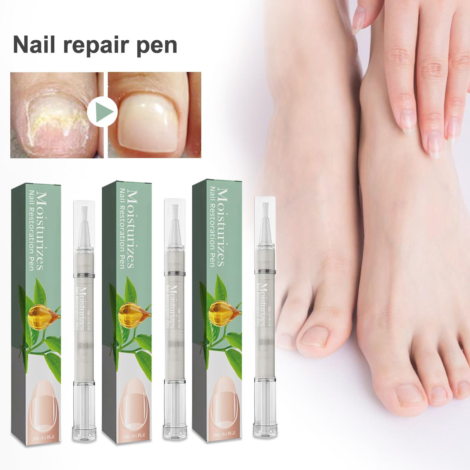 

Уход за ухоженными ногтями на руках и ногах. Рутинный уход за здоровыми ногтями, Ручка для ногтей, Ручка от онихомикоза, Ручка для здоровых ногтей, Увлажняющие ногти, 3 мл One Size