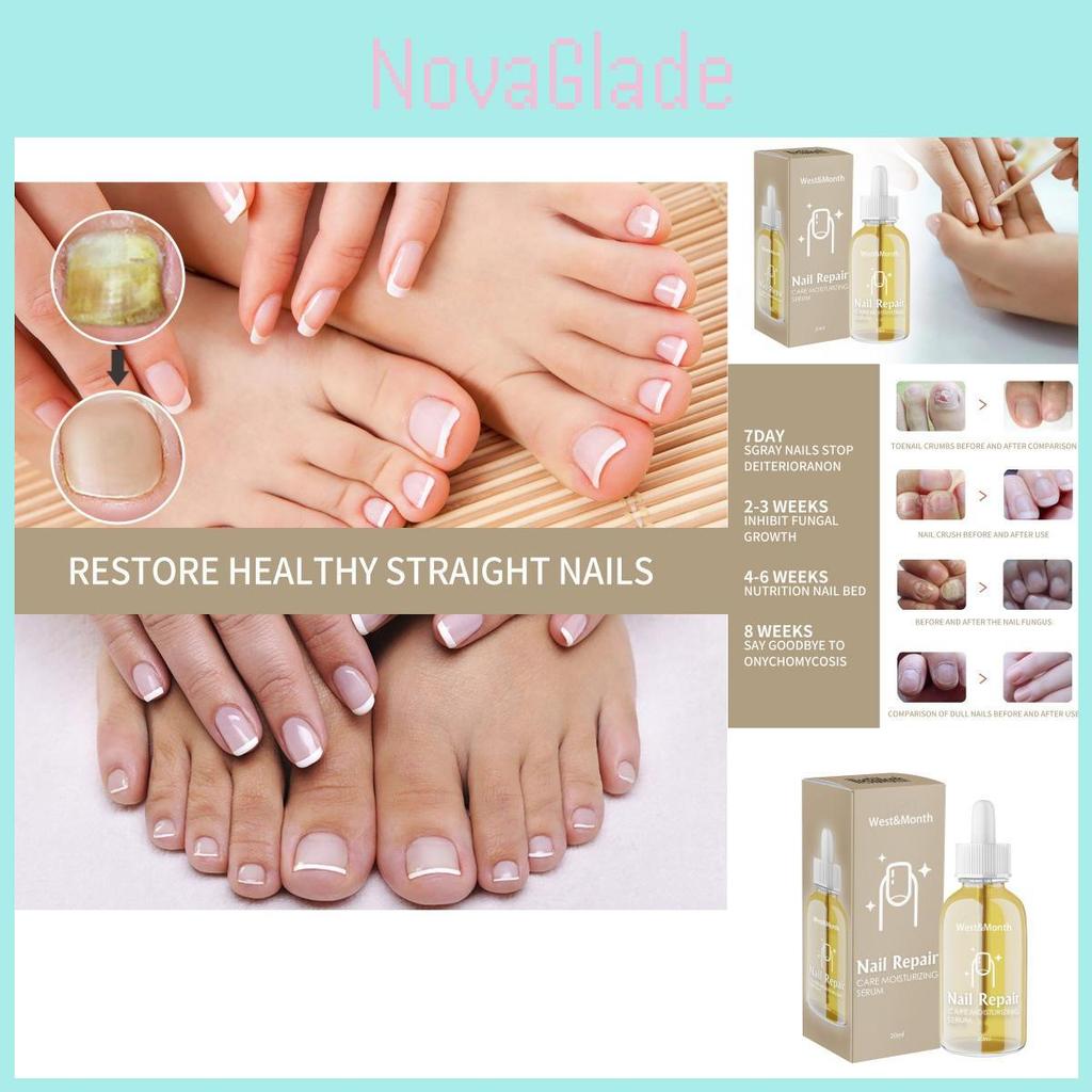 Essence de Réparation pour Ongles West Month Traitement Nourrissant pour Ongles et Orteils Endommagés 20ml