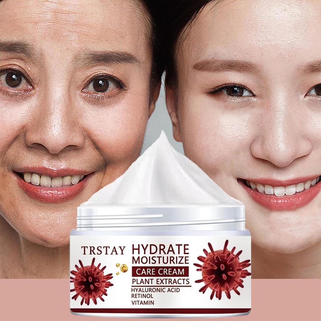 TRSTAY hydratační krém, vitamin C rozjasňující pleťový krém, rozjasňující pleť a zesvětlující skvrny