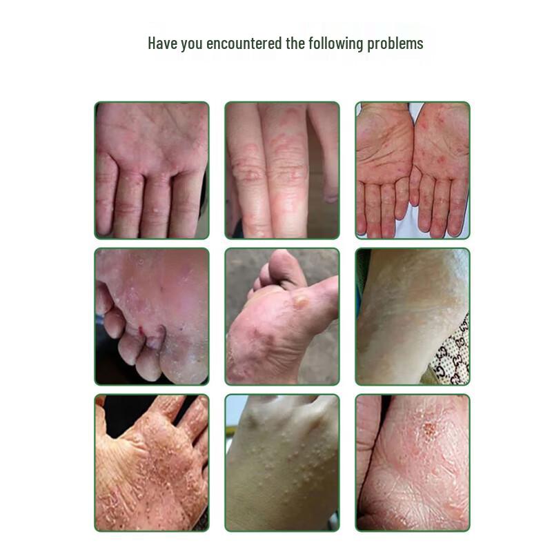 VSEA Herbal Skin Relief Cream