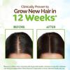 Mamaearth Rosemary & Fenugreek Hair Growth Oil 200ml, Strengthens Roots, Reduces Hair Fall, Thicker Fuller Hair, Natural & Safe