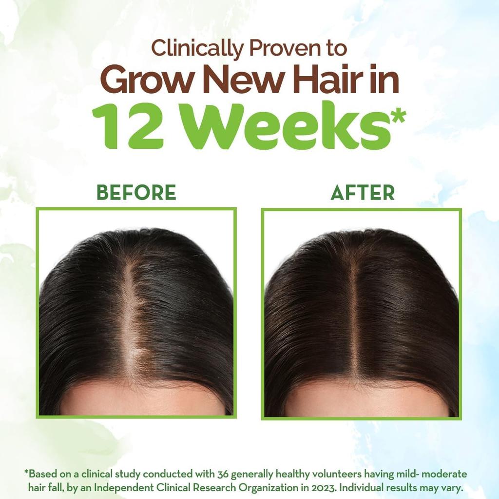 Mamaearth Rosemary & Fenugreek Hair Growth Oil 200ml, Strengthens Roots, Reduces Hair Fall, Thicker Fuller Hair, Natural & Safe