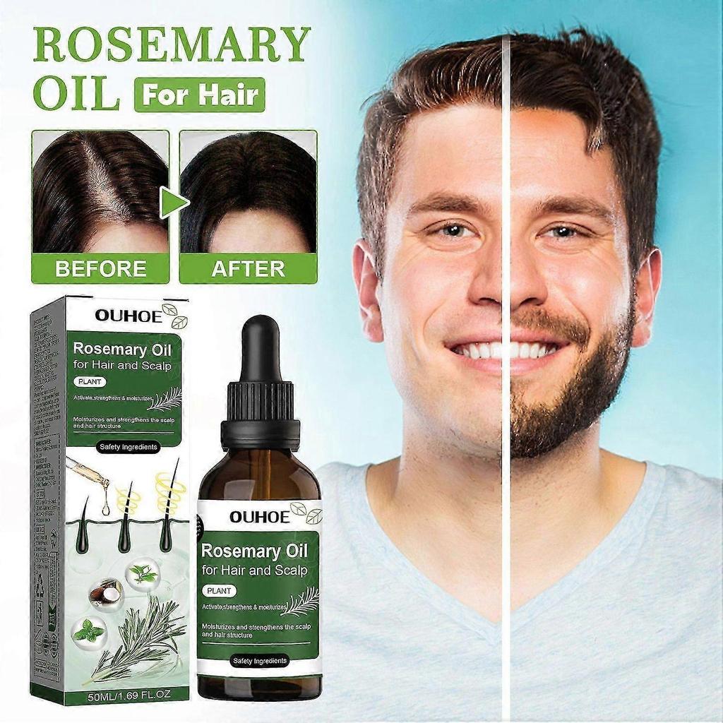 1-3x Rosemary Oil For Hair And Scalp-hair Oil For Hair Loss To Stimulate Hair Growth With Castor Oil 50Ml