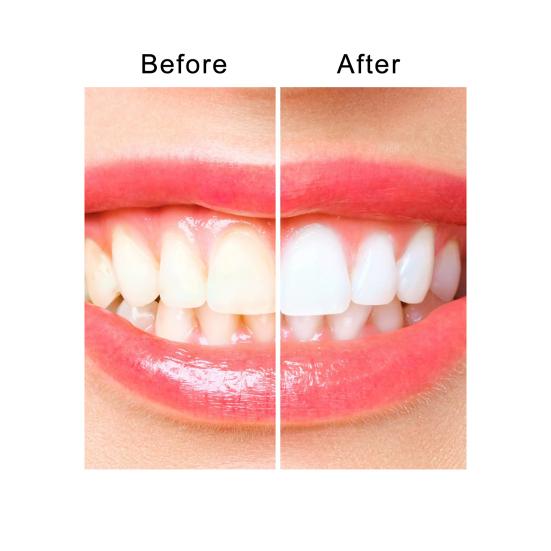 14Pcs Teeth Whitening Strips Travel Friendly Gentle Effective Fresh Breath Teeth Whitening Strips for Teeth