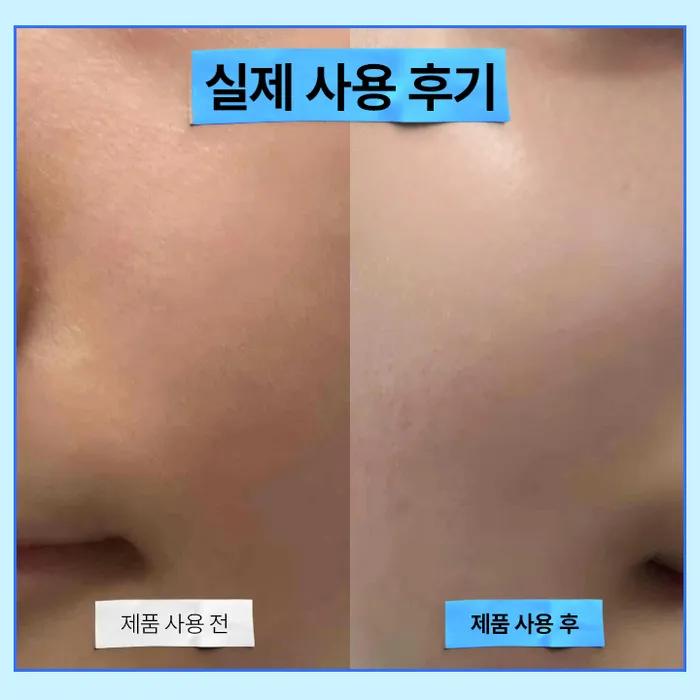 [Moisture Plumping/2-pack]_[2-pack] Resurrection Hyaluronic Acid Quick-drying Moisture Elasticity Ampoule 50ml