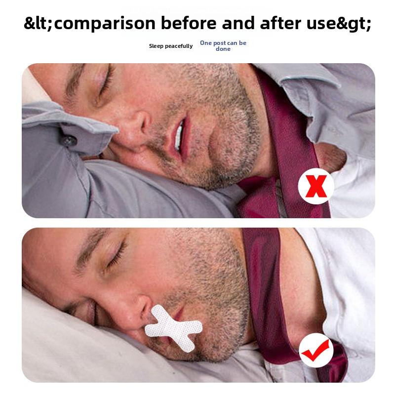 Mouth Breathing Mouth Sticker X Type, Cotton In The Middle, Breathable and Skin-friendly, Anti-opening and Sealing At Night, Shut Up Sticker