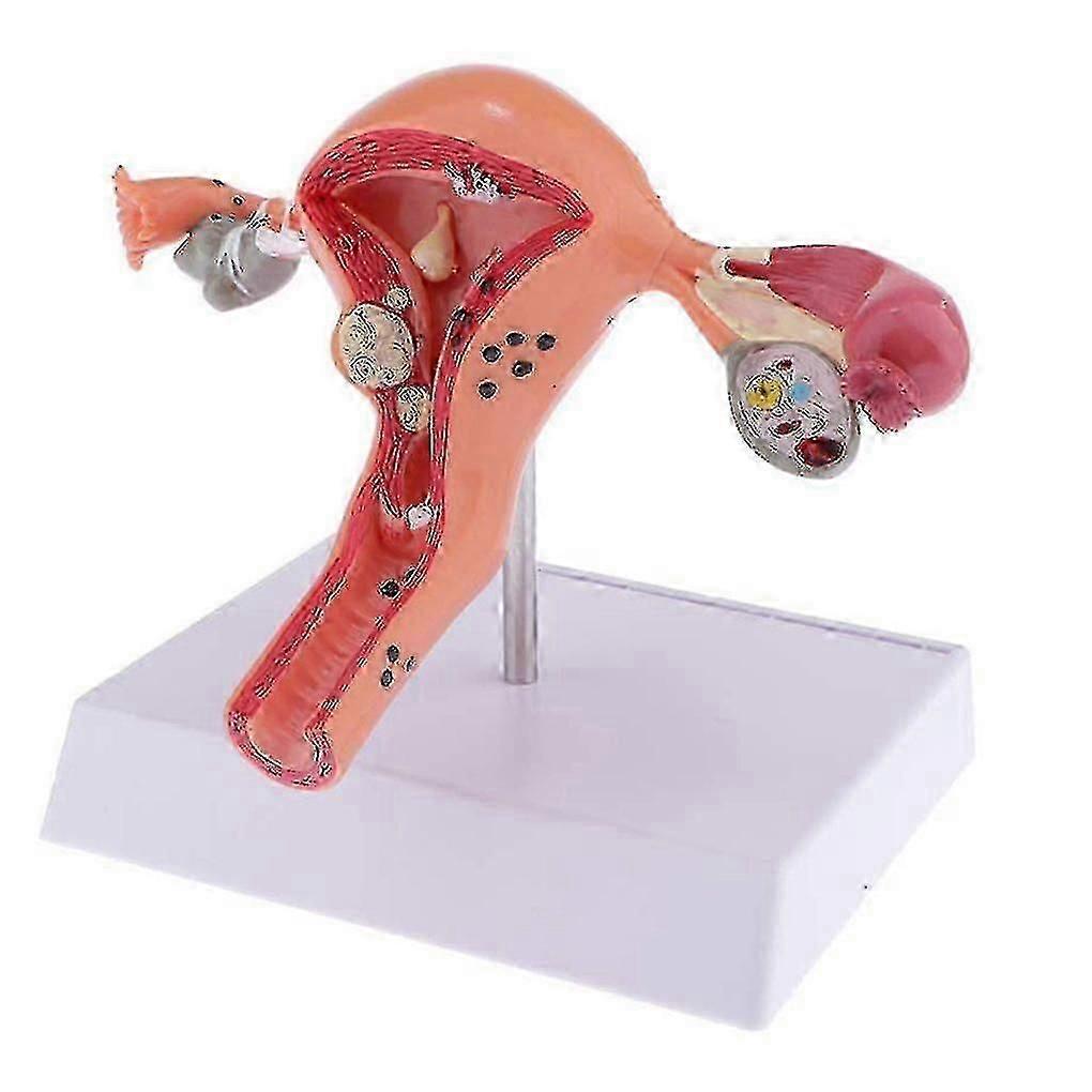 Female Uterus Structure Biological Models Educational Experiment o