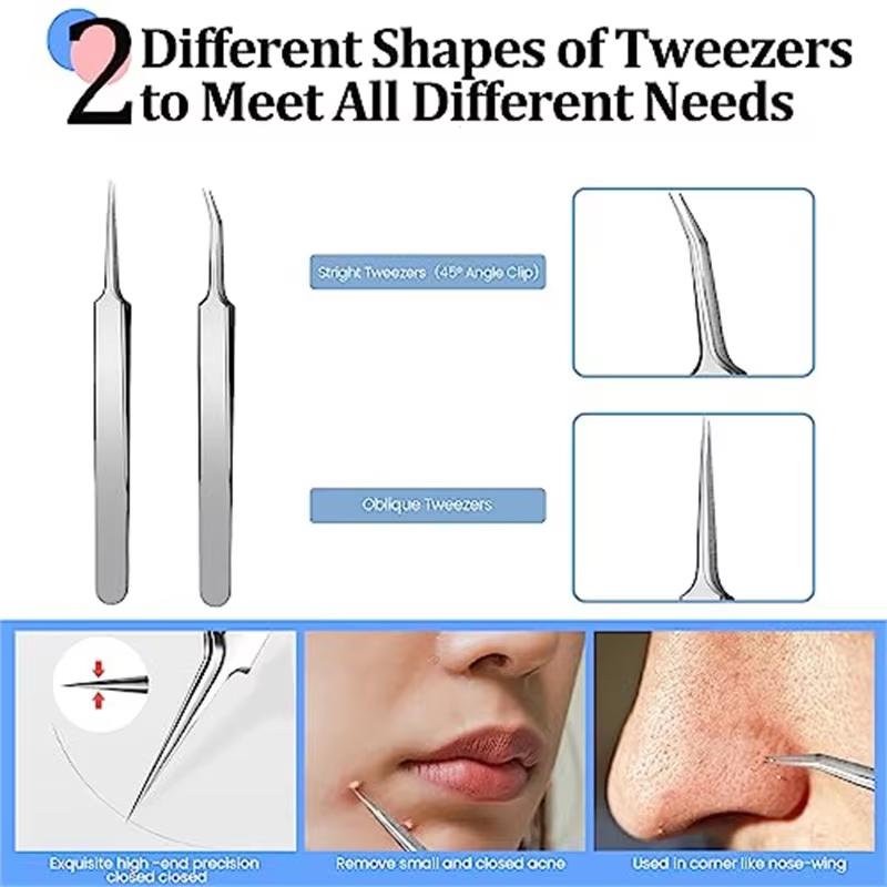 4/8Pcs Ultra-Precise Pimple Tweezers Set - Pro Acne and Blackhead Removal Tool -for Effective Face Care and Skin Purification