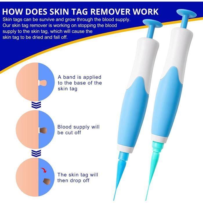 Skin Tag Remover kit,Appareil Pour Enlever Acrochordon Petit, Moyen,Grand Sans Cicatrice Indolore Kit D'élimination Des Acrochordons