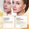 Limited time!!Jaysuing Turmeric Facial Cleanser - Gentle Cleansing For Pores, Refreshing, Oil-Control, Moisturizing, And Hydrating Cleanser