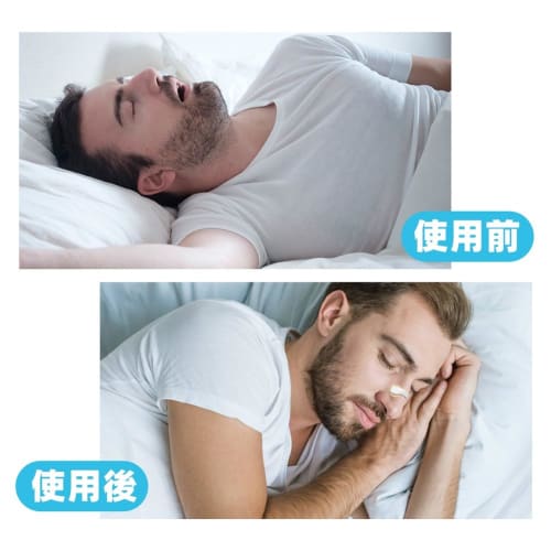 Anti-Snoring Aids, Nasal Dilators with Magnets, Nasal Dilator Tapes, Nose Clips, Snoring Improvement Aids, 15/30-Piece Set, Nasal Breathing Clips, Nas