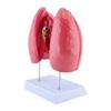 Educational Removable Normal Lung Anatomy Model  Human Anatomical Lung Model with Detachable Parts for Clinical Setting