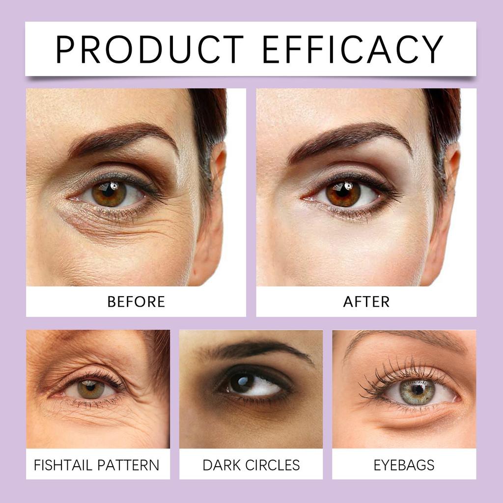EELHOE Anti-Wrinkle Eye Mask (1 Piece): Reduces Fine Lines, Anti-wrinkle and Anti-aging, Brightens the Eye Area, Moisturizes and Firms