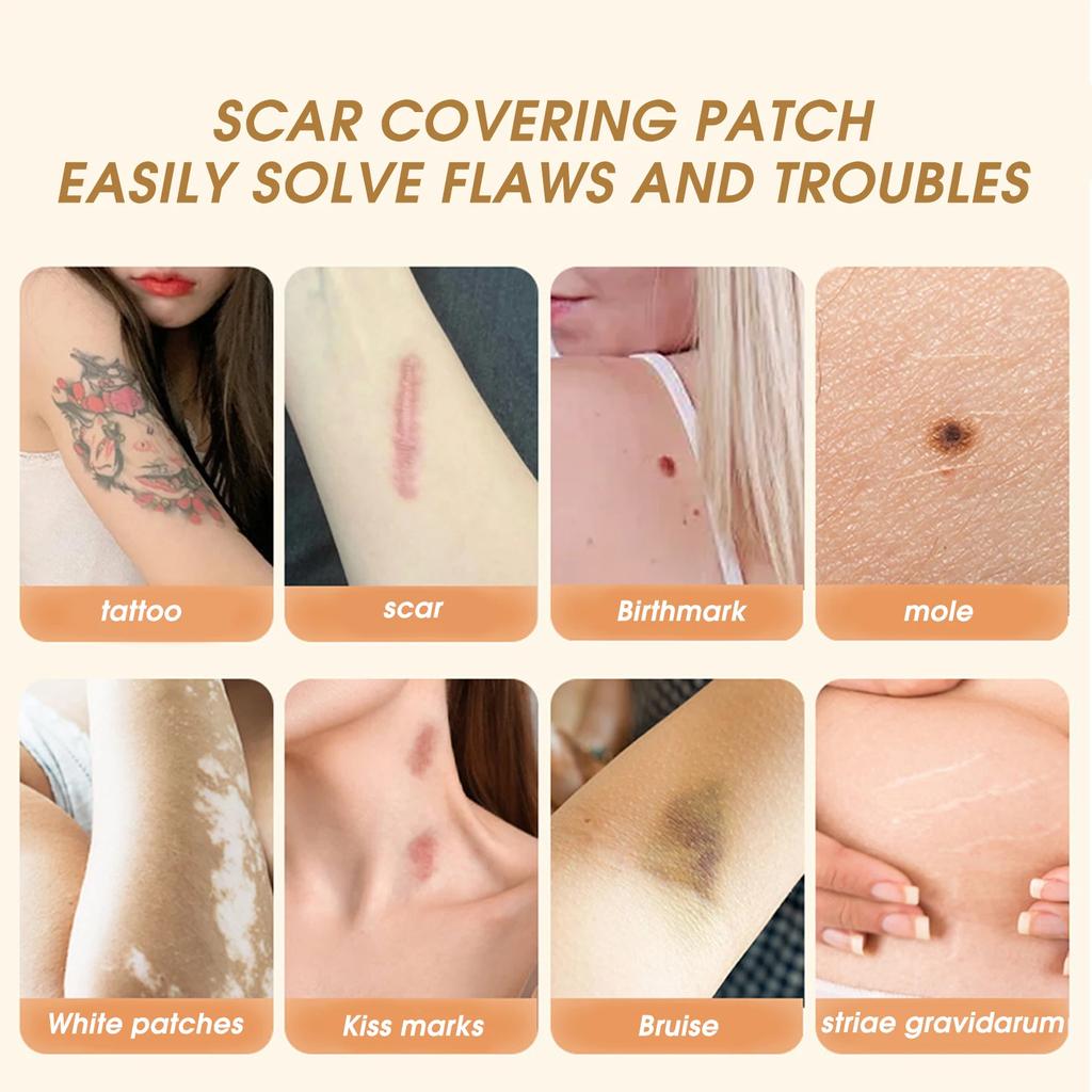 Invisible Skin Color Tattoo Patches Natural-Looking Birthmark Concealer for Arms Legs Back Post-Surgery Cover Up Hypoallergenic