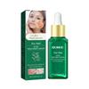 Tea Tree Acne Serum, Cleansing & Repairing Skin, Moisturizing, Suitable for All Skin Types