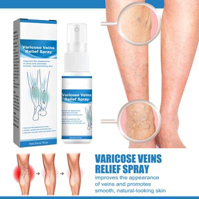 Varicose Spray, Varicose Vein Soothing Spray, Varicose Veins Spray, Strengthen Capillary Health And Improve Blood Circulation 30ml